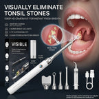 Tonsil Stone Remover with 1080P HD Camera - Visual Removal Kit 6 LED Lights 5 Stainless Tips USB Rechargeable iOS Android App Oral Care Tool