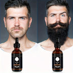 Sandalwood Beard Care Essential Oil 30ml, Plant-Based Beard Oil for Men, Moisturizes Softens & Smooths Facial Hair for a Polished Well-Groomed Look